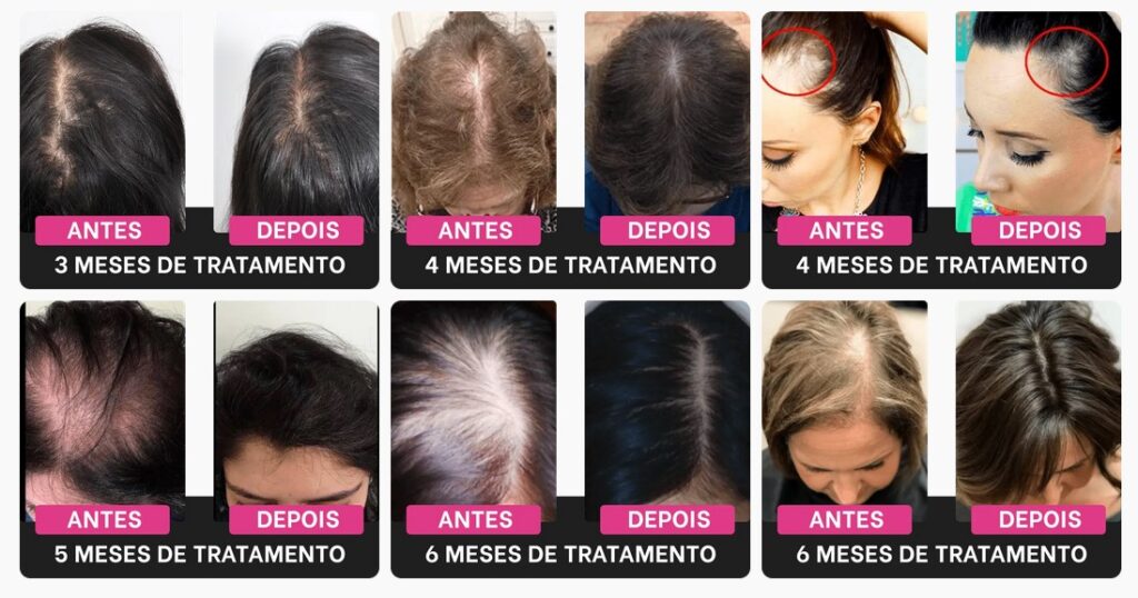 harmony hair funciona, harmony hair preço, harmony site oficial, harmony onde comprar